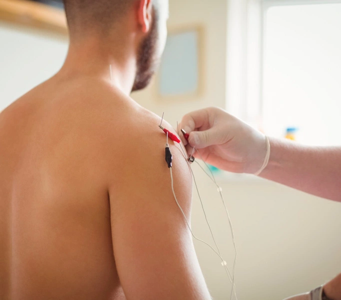 Electro Punción en TeraMedic